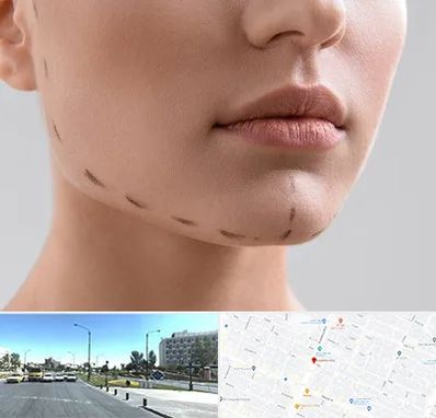 عمل زاویه فک در بلوار کلاهدوز مشهد