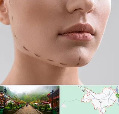 عمل زاویه فک در فومن