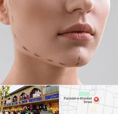 عمل زاویه فک در 15 خرداد