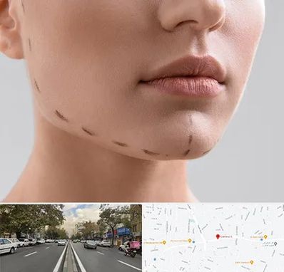 عمل زاویه فک در دولت