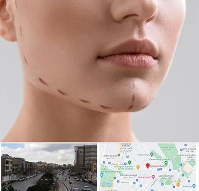 عمل زاویه فک در بلوار فردوسی مشهد