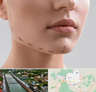 عمل زاویه فک در مراغه