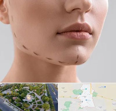 عمل زاویه فک در کاشمر