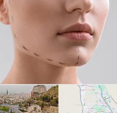 عمل زاویه فک در فرهنگ شهر شیراز