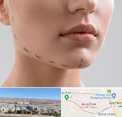 عمل زاویه فک در شهرک گلستان شیراز