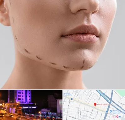 عمل زاویه فک در آبرسان تبریز