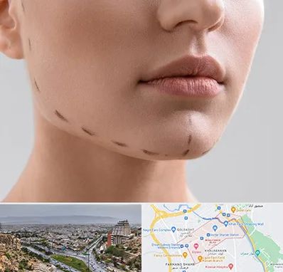 عمل زاویه فک در معالی آباد شیراز