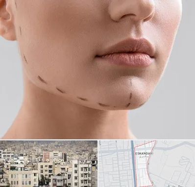 عمل زاویه فک در اسکندری