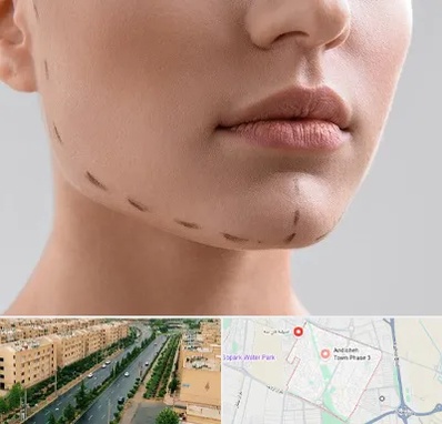 عمل زاویه فک در فاز سه اندیشه