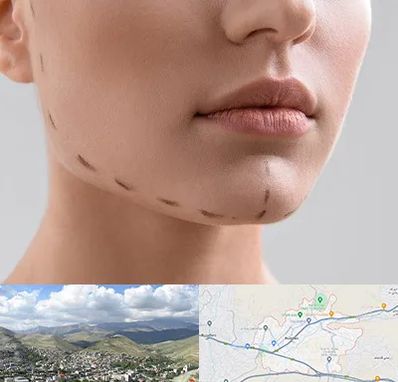 عمل زاویه فک در رودهن