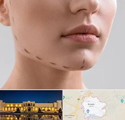 عمل زاویه فک در برازجان