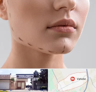 عمل زاویه فک در وحیدیه شهریار