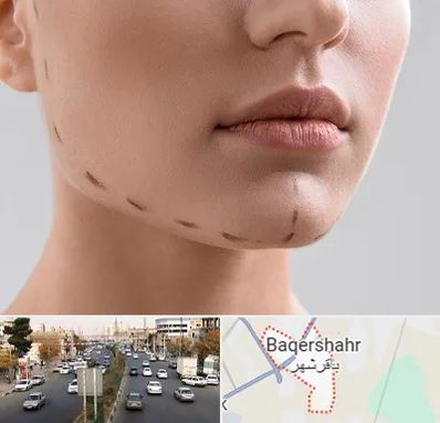 عمل زاویه فک در باقرشهر
