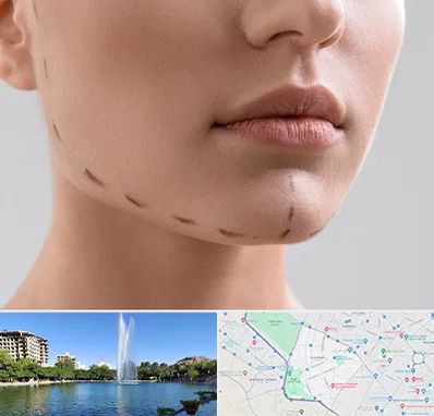 عمل زاویه فک در کوهسنگی مشهد