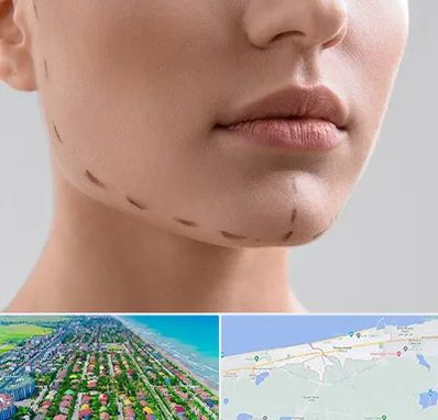 عمل زاویه فک در فریدونکنار