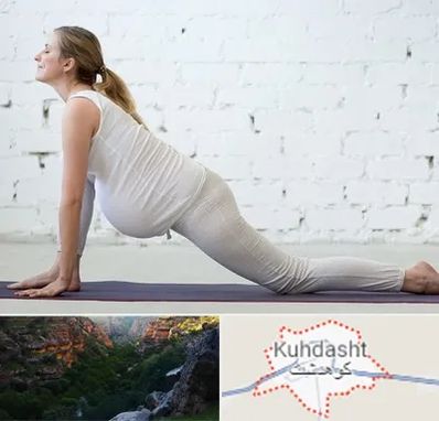 کلاس پیلاتس بارداری در کوهدشت