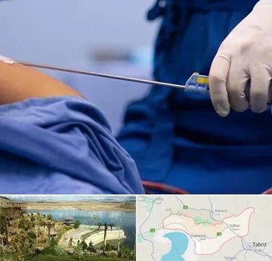 پیکر تراشی در شبستر