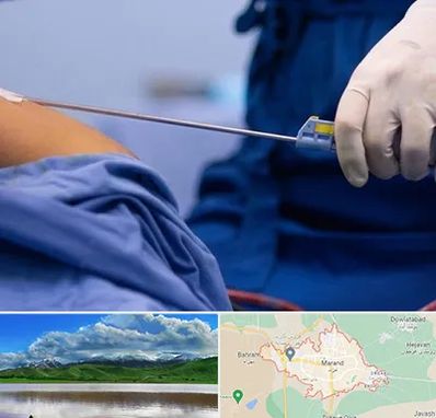 پیکر تراشی در مرند