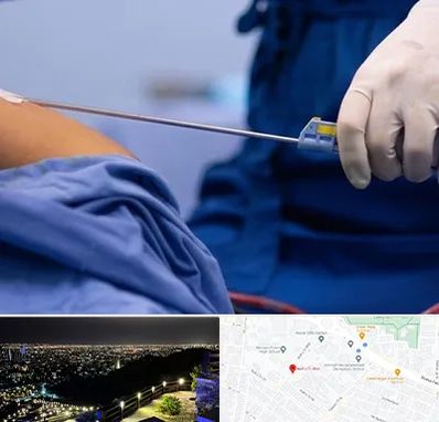 پیکر تراشی در هفت تیر مشهد