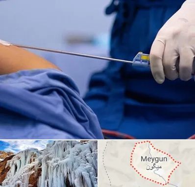 پیکر تراشی در میگون