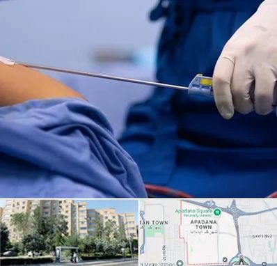 پیکر تراشی در آپادانا