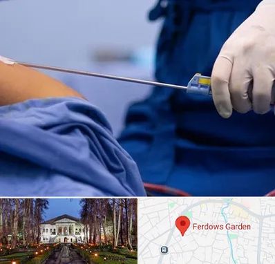 پیکر تراشی در باغ فردوس