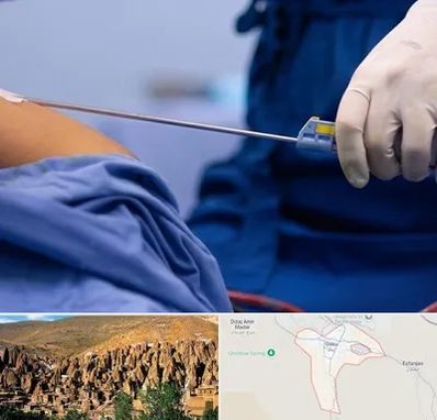 پیکر تراشی در اسکو