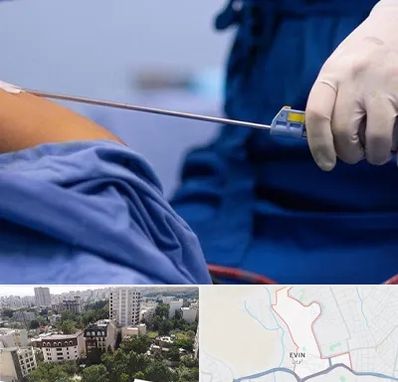 پیکر تراشی در اوین