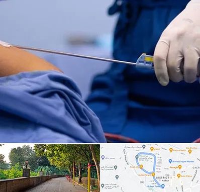 پیکر تراشی در بلوار گیلان رشت