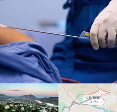 پیکر تراشی در لواسان