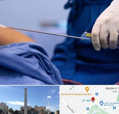 پیکر تراشی در فلکه گاز شیراز