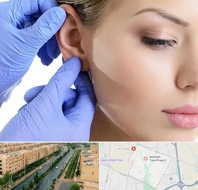 اتوپلاستی در فاز سه اندیشه