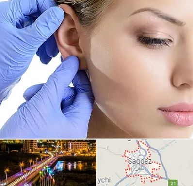 اتوپلاستی در سقز