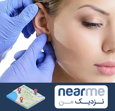 اتوپلاستی در نزدیک من