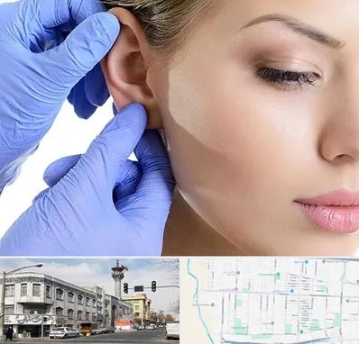 اتوپلاستی در 17شهریور