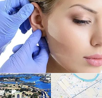 اتوپلاستی در کوروش اهواز