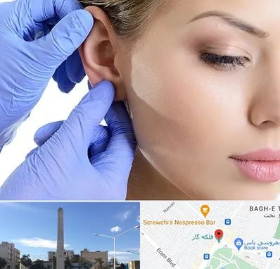 اتوپلاستی در فلکه گاز شیراز