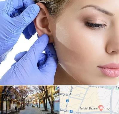 اتوپلاستی در تربیت تبریز