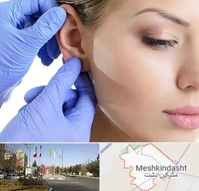 اتوپلاستی در مشکین دشت