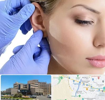 اتوپلاستی در صیاد شیرازی مشهد