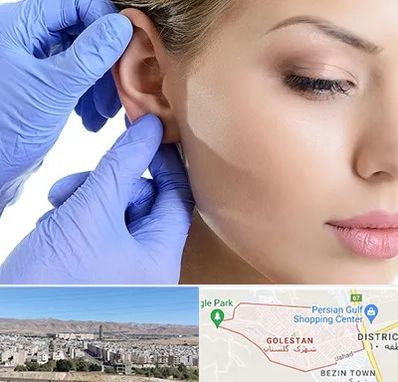 اتوپلاستی در شهرک گلستان شیراز