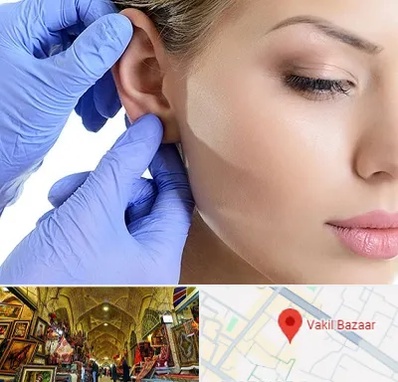 اتوپلاستی در بازار وکیل شیراز