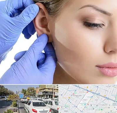 اتوپلاستی در مفتح مشهد