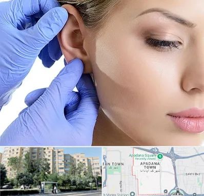 اتوپلاستی در آپادانا