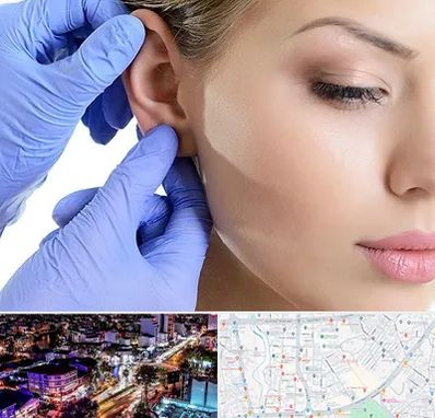 اتوپلاستی در منظریه رشت