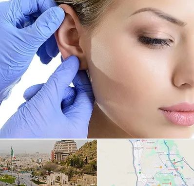 اتوپلاستی در فرهنگ شهر شیراز