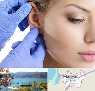 اتوپلاستی در مریوان
