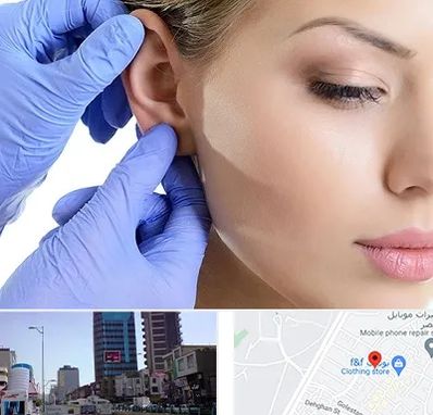 اتوپلاستی در چهارراه طالقانی کرج