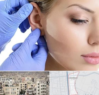 اتوپلاستی در اسکندری