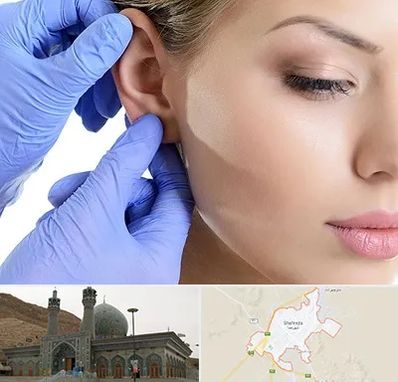 اتوپلاستی در شهرضا